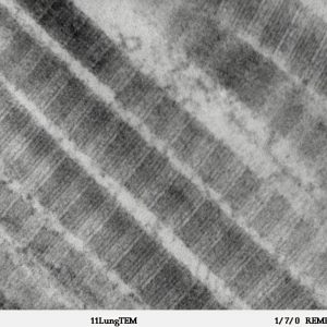 Immagine al microscopio del collagene