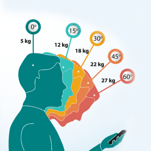 Illustrazione che mostra la correlazione tra il piegamento del collo e il peso assorbito dalla cervicale